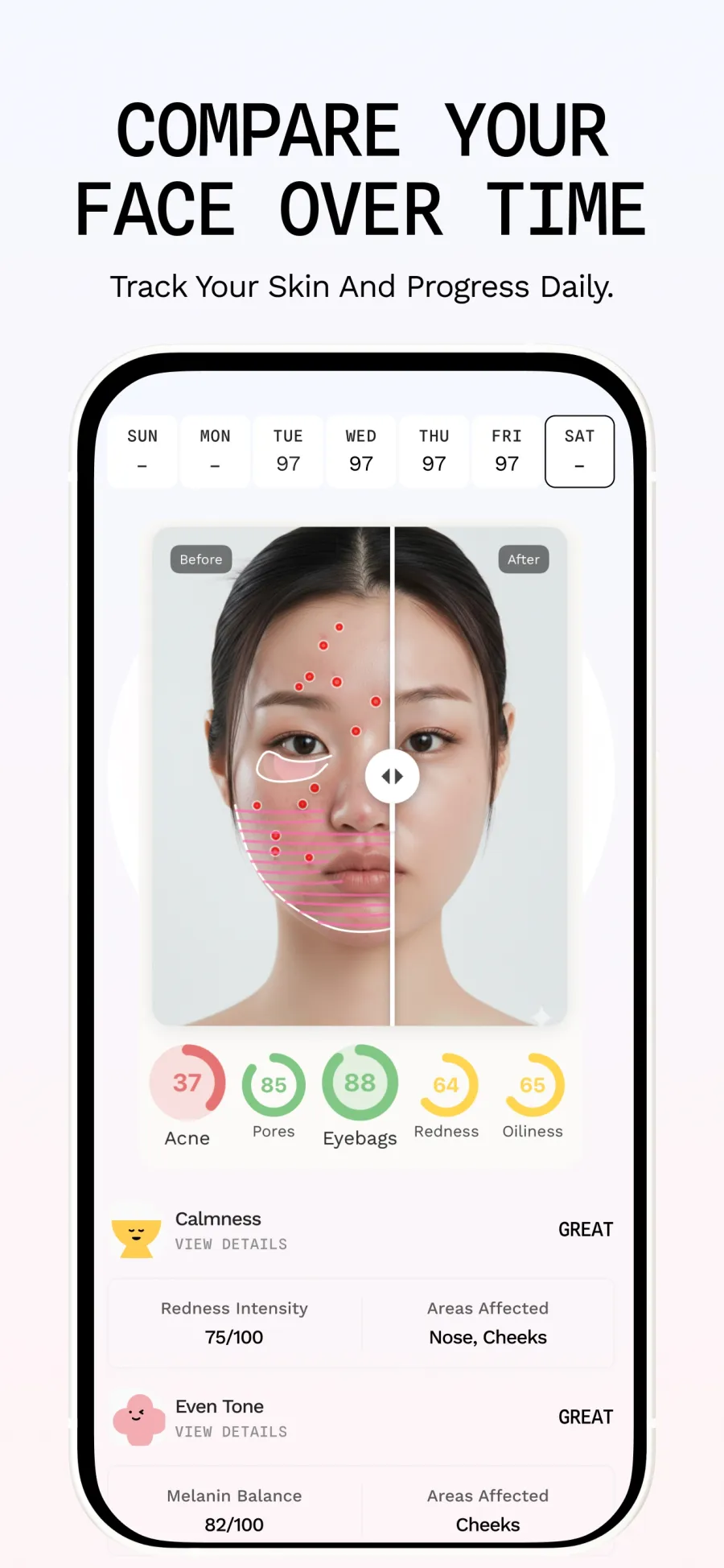 Venus App Store screen: compare your face over time, with per-concern skin scores